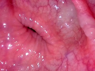 Take in the view peering up my descending colon